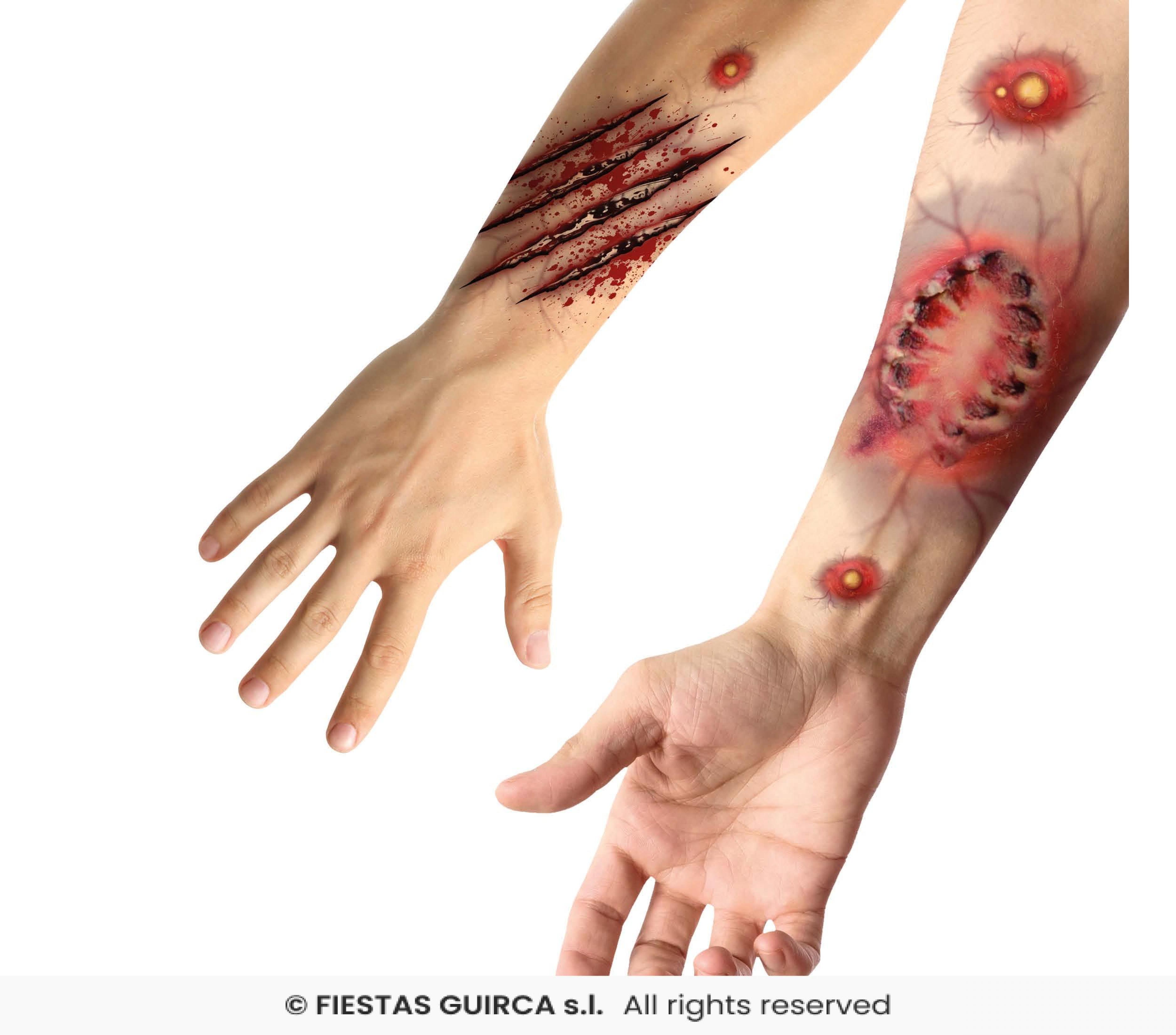 Tatouages morsures et griffures