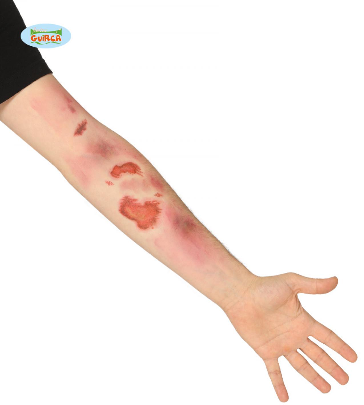 Tatouages écorchures