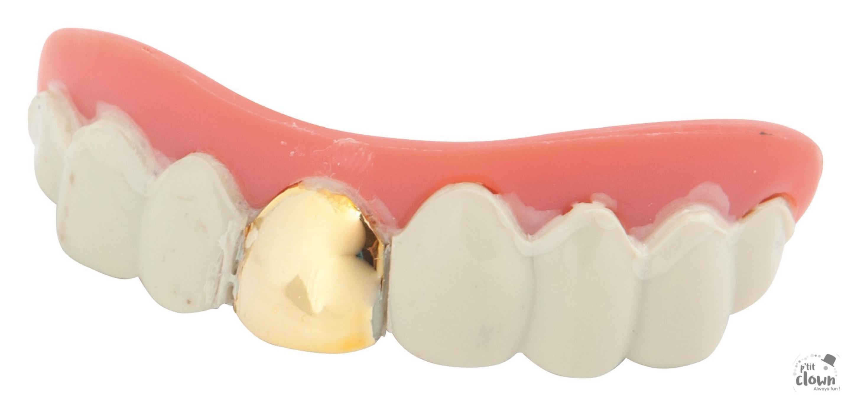 Dentier avec dent en or