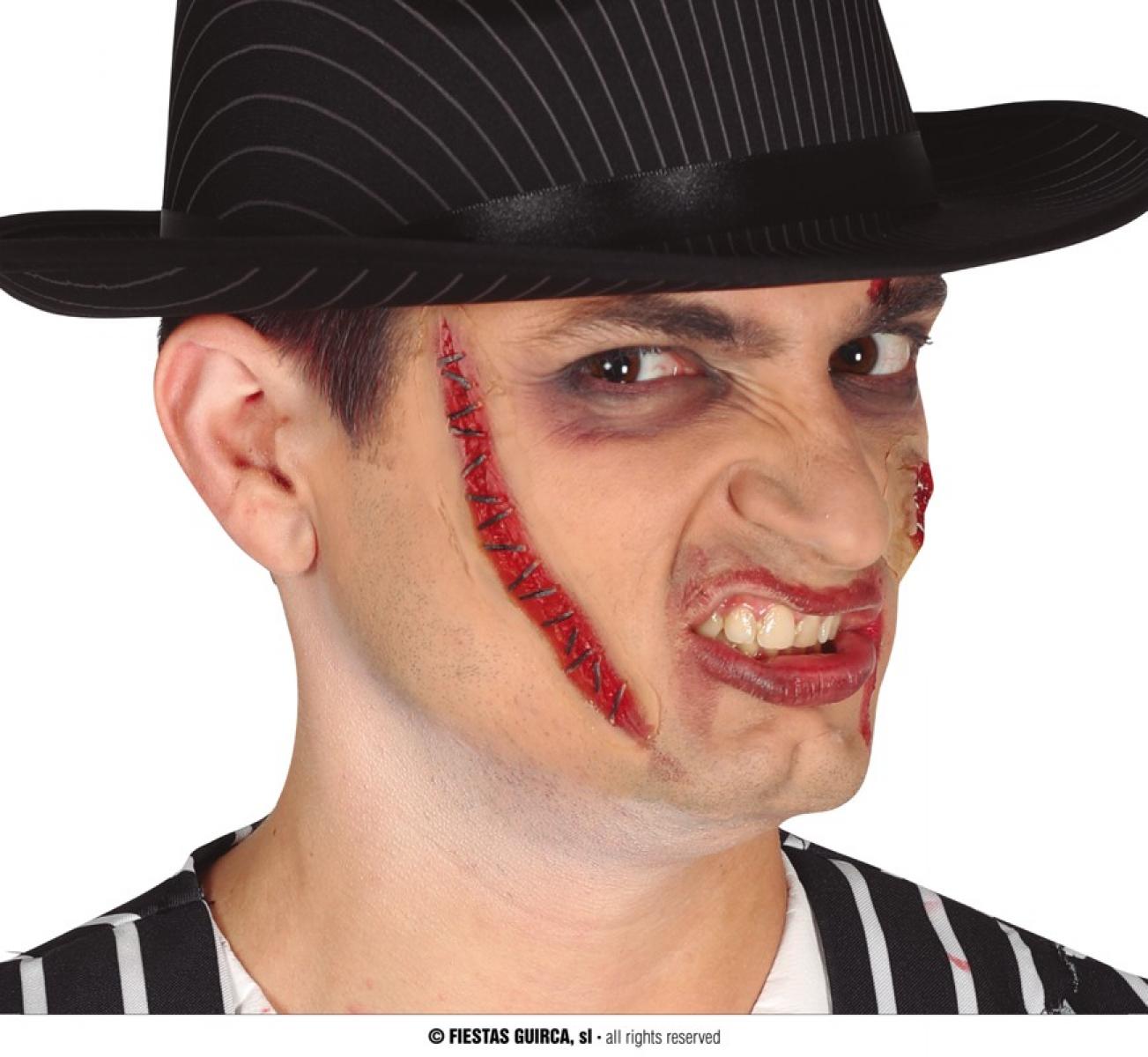 Cicatrice points de suture avec colle