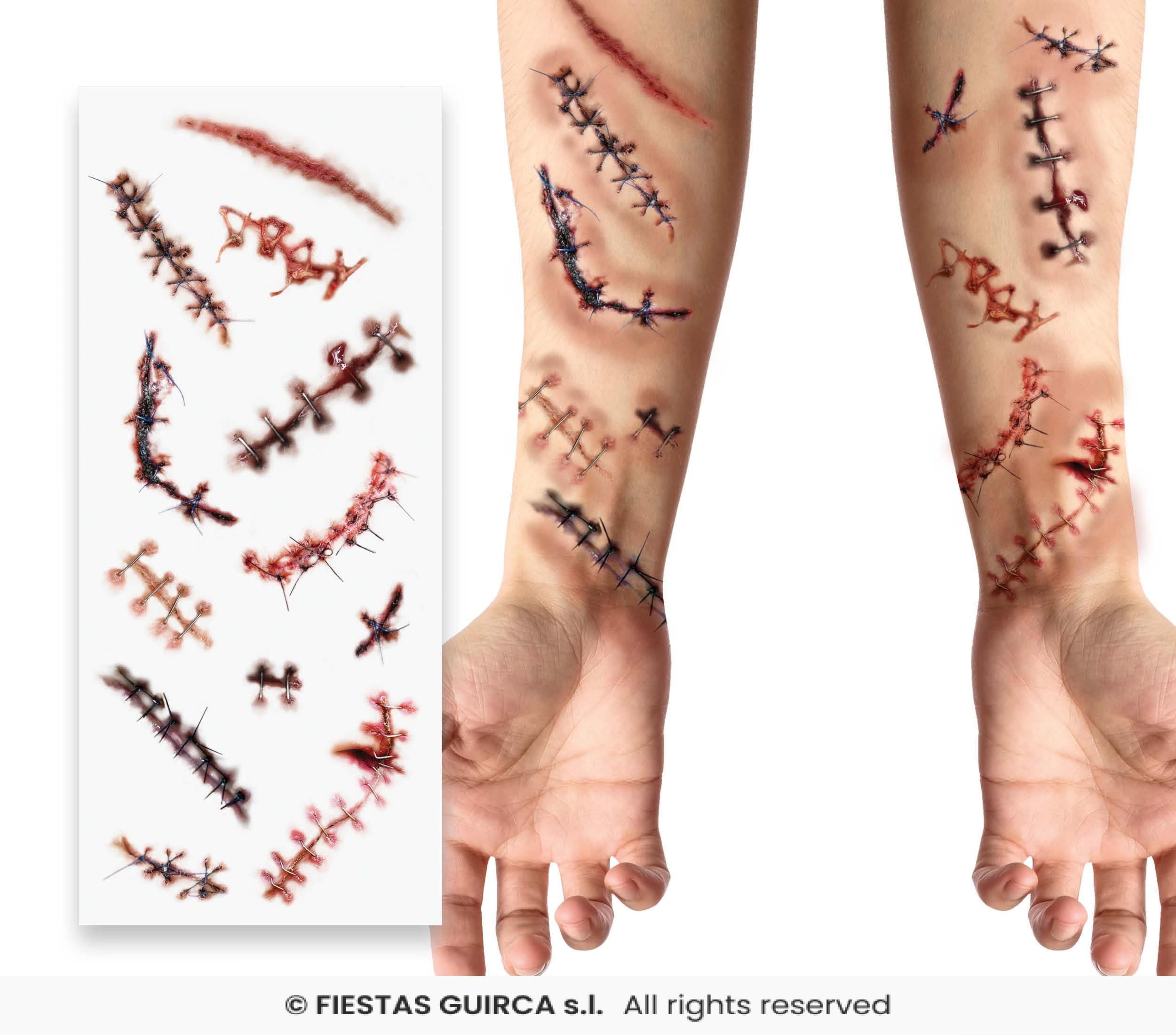 Tatouages blessures cicatrices infectées