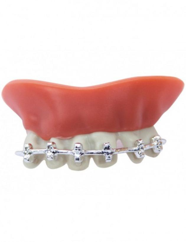 Dentier avec appareil dentaire